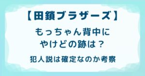 【田鎖ブラザーズ】もっちゃん背中にやけどの跡は？犯人説は確定なのか考察の解説記事のアイキャッチ